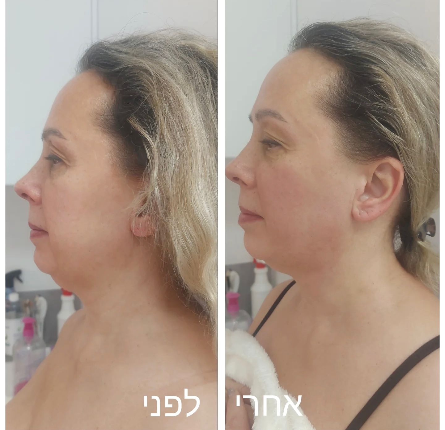 לפני ואחרי 2